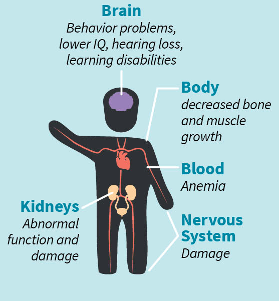 Lead poisoning: What parents should know and do - Harvard Health