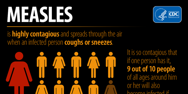 Measles is highly contagious and spreads through the air when a person coughs or sneezes