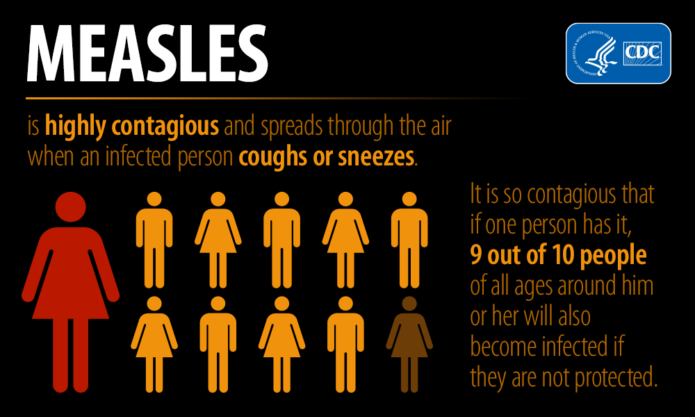 Measles is highly contagious and spreads through the air when a person coughs or sneezes