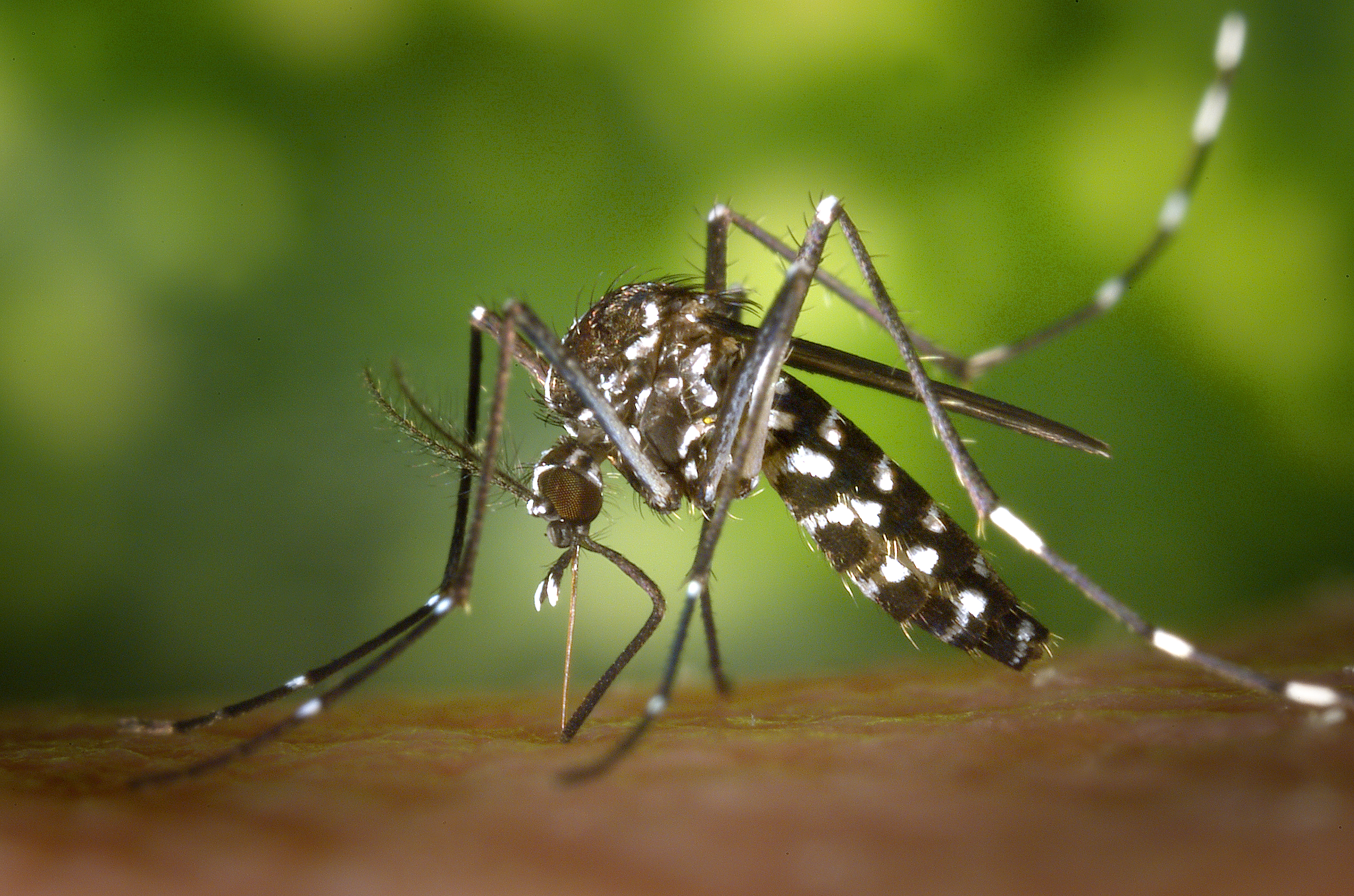 Congenital Zika Virus Infection
