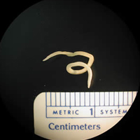 Anasakiasis parasitic nematode