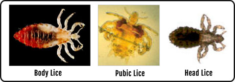 body lice skin