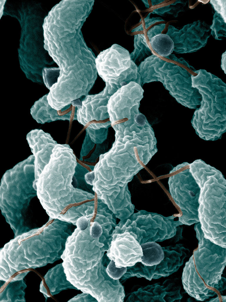 Microscopic image of Campylobacter