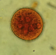 entaemoeba coli cyst 6 nuclei