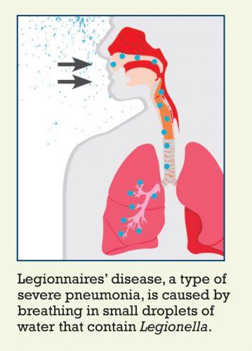 Legionellosis