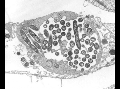 Legionella fibroblast