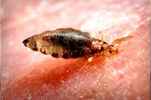 Body lice on skin