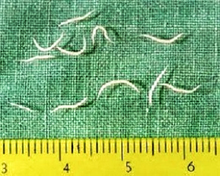 pinworm eggs visible