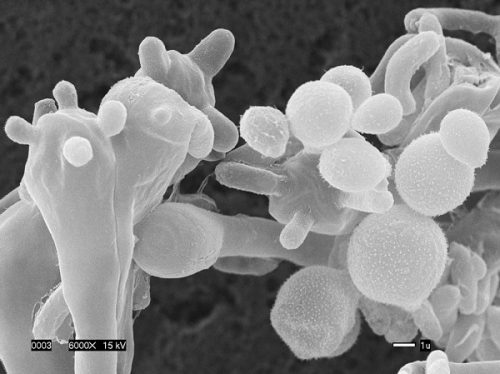 Micrograph of Cryptococcus gattii fungus