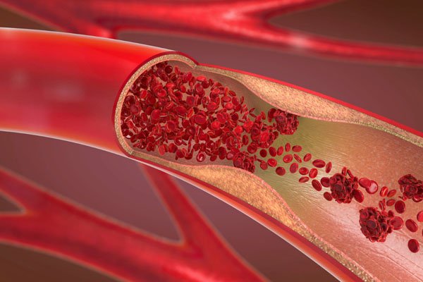 Illustration of blood vessels