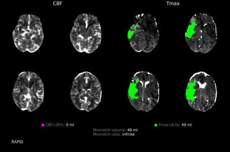 RAPID Scan Images of the Brain