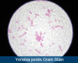Gram Stain of Yersinia pestis
